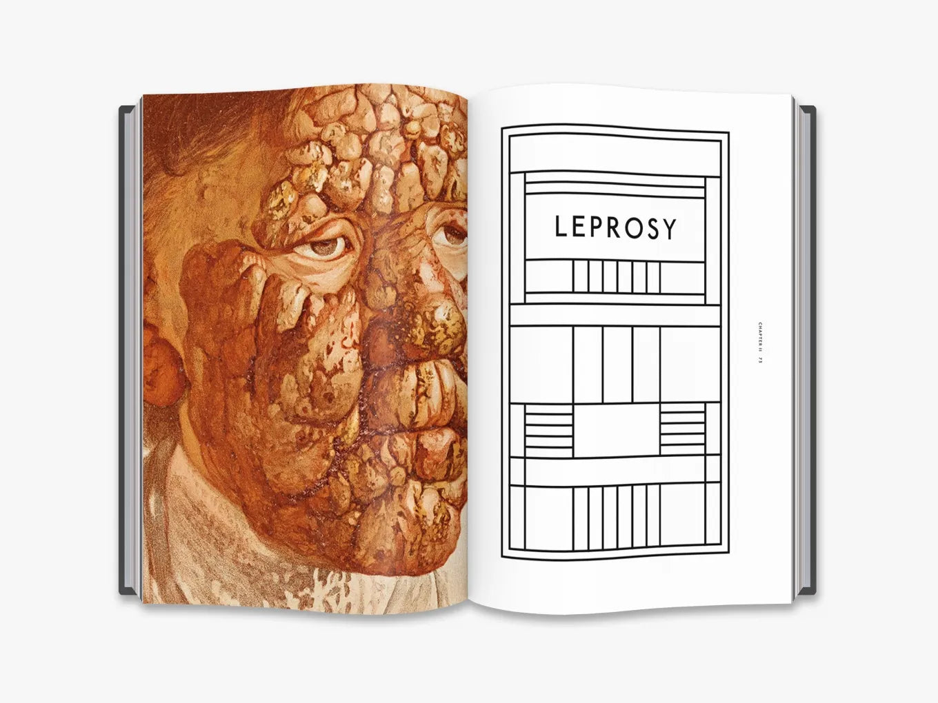 The Sick Rose. Disease and the Art of Medical Illustration