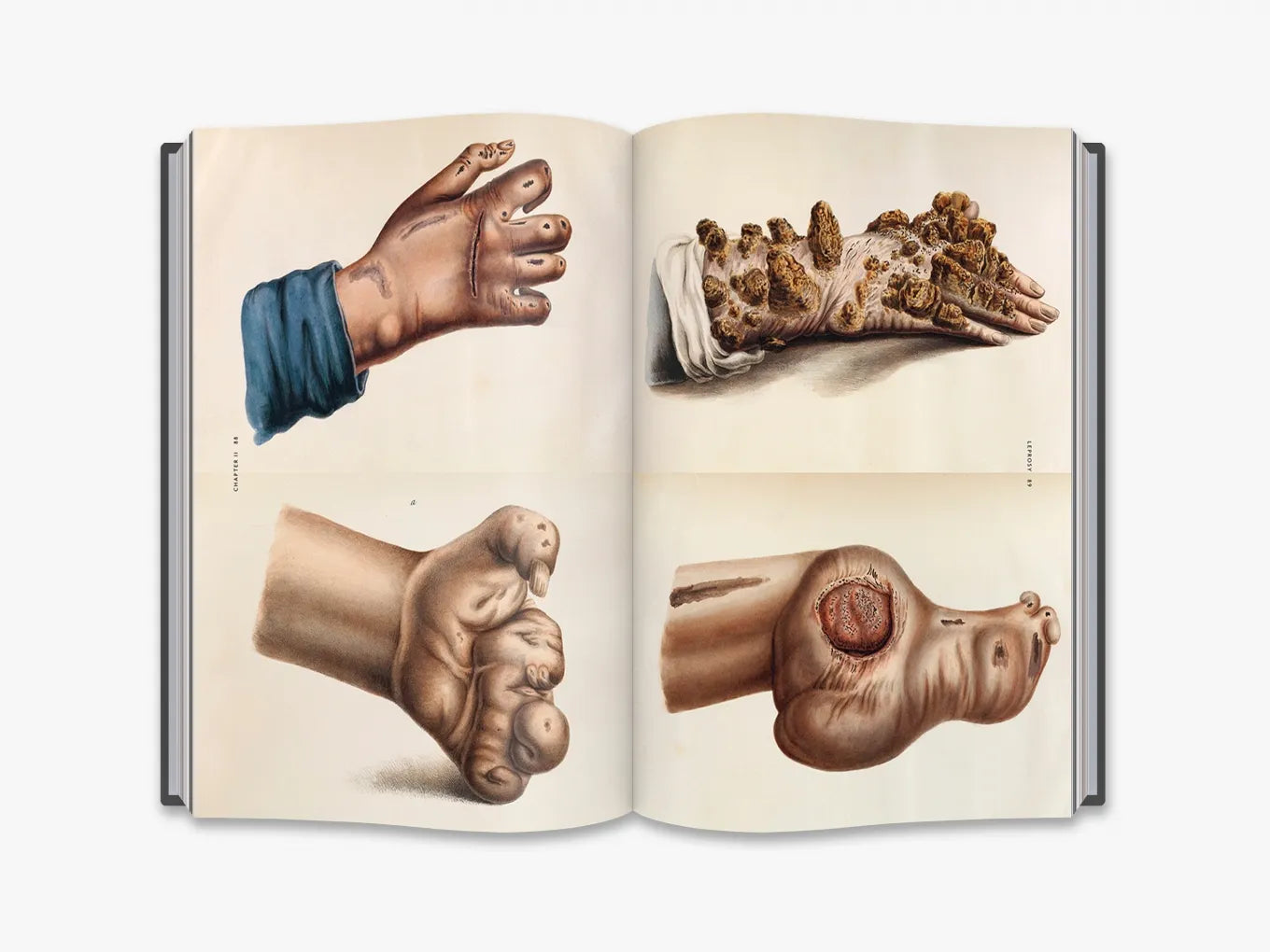 The Sick Rose. Disease and the Art of Medical Illustration