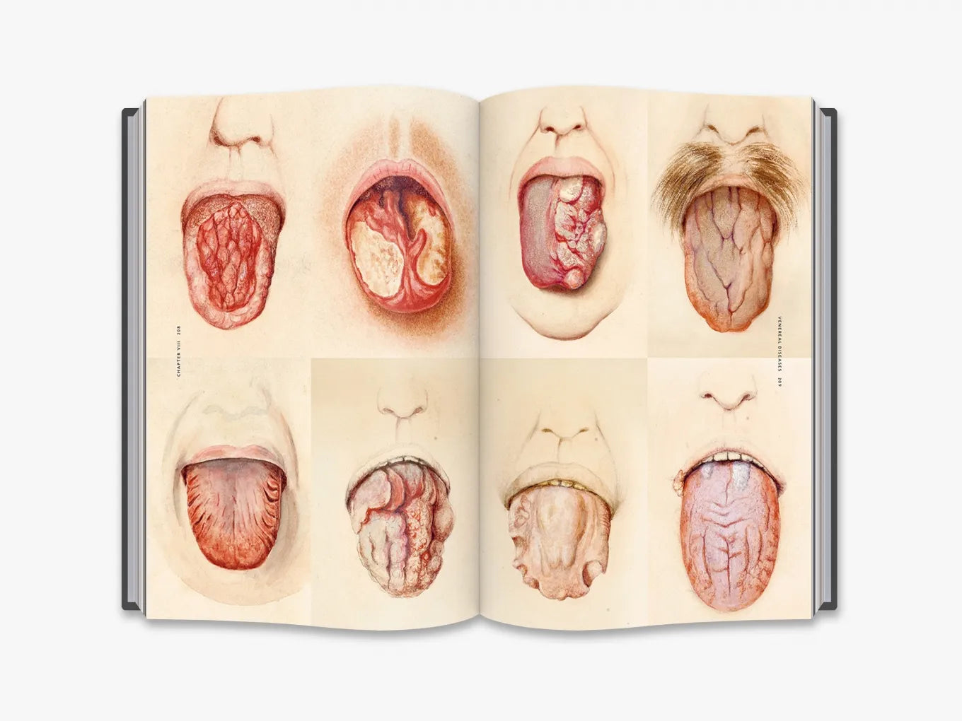 The Sick Rose. Disease and the Art of Medical Illustration