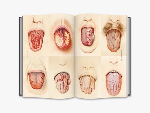 The Sick Rose. Disease and the Art of Medical Illustration